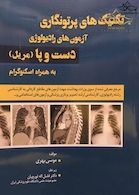 تکنیک های پرتونگاری آزمون های رادیولوژِی دست و پا (مریل) به همراه اسکنوگرام سیاه و سفید